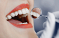 Brilliant Smile with Teeth Whitening Melbourne CBD