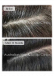 Real Care with Natural Scalp Treatment That Supports Healthy Hair 