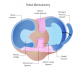 Find Practical Options for Osteoarthritis Treatment